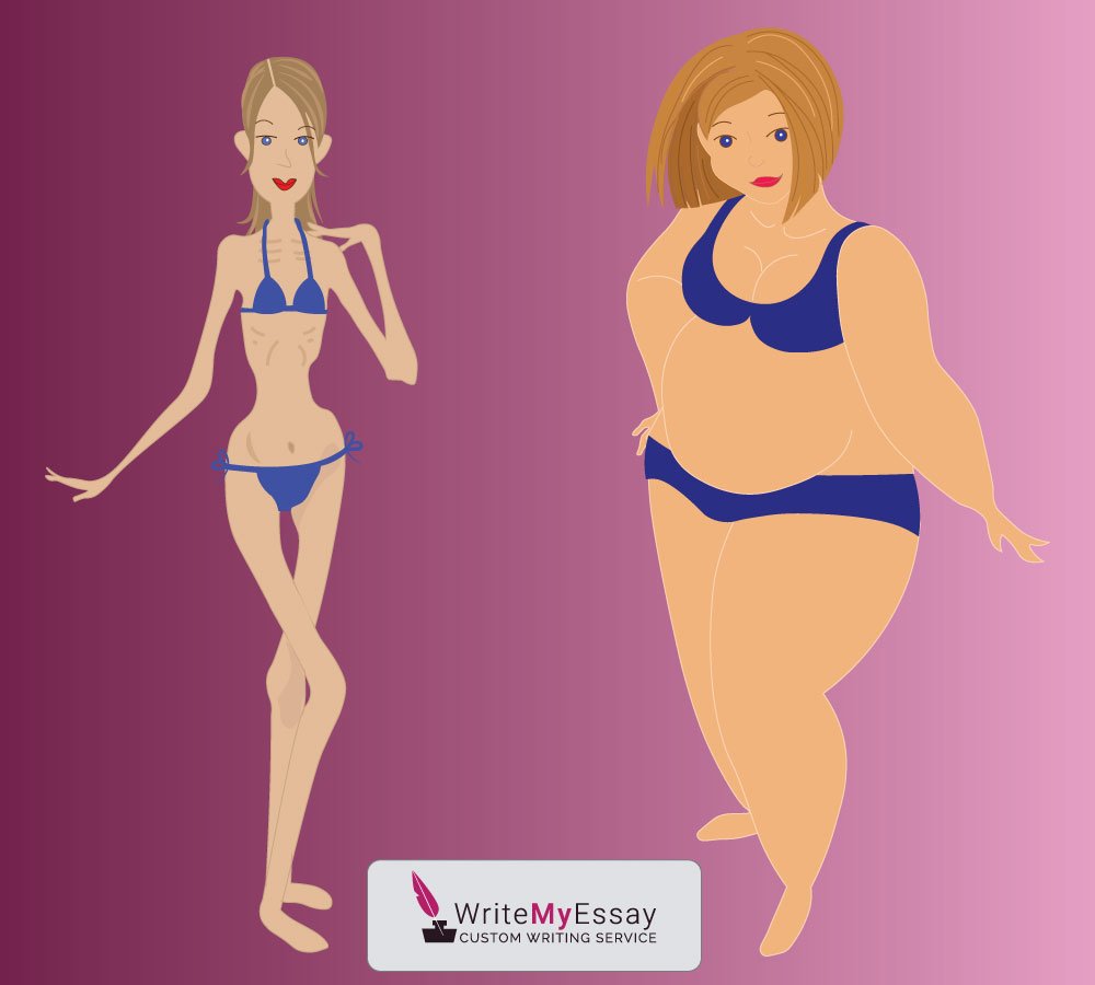 Anorexia and obesity – two sides to one story essay sample